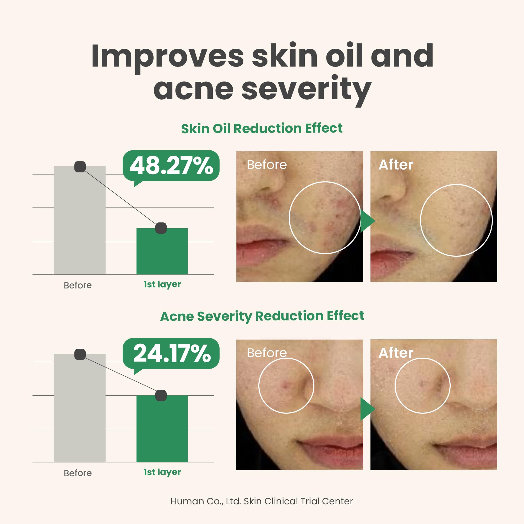 AXIS-Y Spot The Difference Blemish Spot Treatment - 4-Terpineol 2% Niacinamide AHA BHA Soothes Breakouts & Skin Barrier Repair - Vegan Korean Skin Care Face Serum - 0.50 fl. oz.